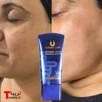 فروش کرم ضد لک