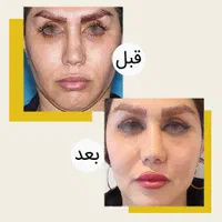 همه جراحی های زیبایی باشرایط اقساط و وام بدون ضامن|خدمات آرایشگری و زیبایی|تهران, فلسطین (میدان انقلاب)|دیوار