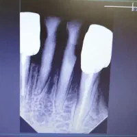 آموزش دستیاری دندانپزشکی