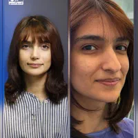 عمل بینی گوشتی و استخوانی / اقساط/شیراز