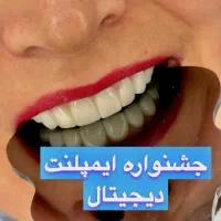 جشنواره ایمپلنت دیجیتال/کاشت دندان/دندانپزشکی