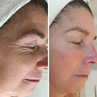 متفاوت ترین آموزش فیشیال در زرند|خدمات آموزشی|زرند, |دیوار