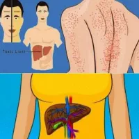 دمنوشا گیاهی طب سنتی