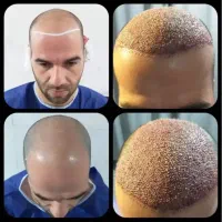 جشنواره نوروزی کاشت تخصصی موشیرازی ۸میلیون باضمانت