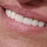 دندان مصنوعی|پزشکی|کرمانشاه, |دیوار