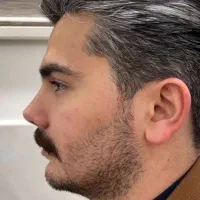 جراحی و عمل بینی توسط متخصص|خدمات آرایشگری و زیبایی|چهارباغ, |دیوار