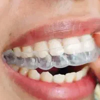 دندانسازی(دندان مصنوعی)تکی،چندتایی،کامل|آرایشی، بهداشتی، درمانی|کرمان, |دیوار