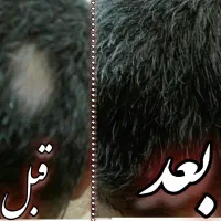 پرپشت شدن مو و رویش موی جدید|آرایشی، بهداشتی، درمانی|گناباد, |دیوار