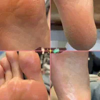 آموزش پدیکور|خدمات آموزشی|بروجرد, |دیوار