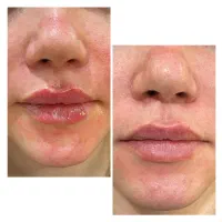 انجام خدمات زیبایی