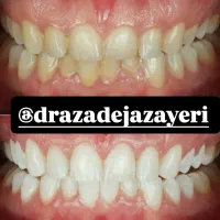 تخفیف خدمات دندانپزشکی|خدمات آرایشگری و زیبایی|رشت, گلسار|دیوار