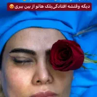 نیازمند فوری مدل تخلیه چربی غبغب وبلفاروپلاستی