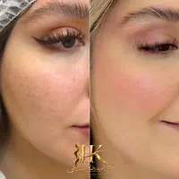 پی آر پی تخصصی /  توسط پزشک متخصص|خدمات زیبایی و سلامت|مشهد, شهید فرامرز عباسی|دیوار
