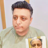 پروتز مو|آرایشی، بهداشتی، درمانی|تهران, سلسبیل جنوبی|دیوار