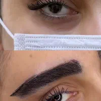 کاشت مو،ریش،ابرو