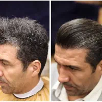 کراتین تراپی مو و ریش آقایان