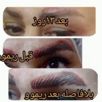 خدمات و آموزش میکرو پیگمنتیشن،میکرو بلیدینگ،ریموو
