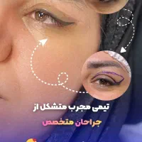 بلفارو پلاسی متخصص چشم ۷ت