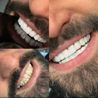 دندانپزشکی ، نصف قیمت جاهای دیگه