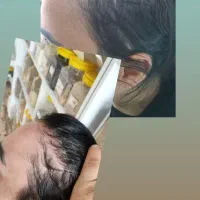 رشد مجدد رفع ریزش و و مشکلات سکه ای