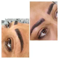 مدل میکروبلیدینگ