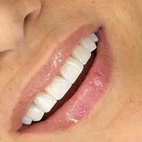 تخفیفات ۳۰ درصدی افتتاح مطب دندانپزشکی|خدمات آرایشگری و زیبایی|اهواز, کیانپارس |دیوار