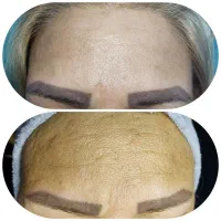 اولین اتاق پوست صومعه سرا با تراپی های درمانی