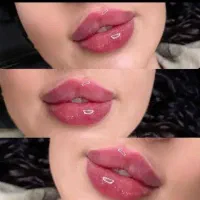 تزریق ژل فیلربوتاکس تخفیفات50درصدی برای زیباجویان|خدمات آرایشگری و زیبایی|زاهدان, |دیوار