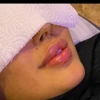 آموزش ژل و بوتاکس نیدلینگ|خدمات آموزشی|رفسنجان, |دیوار