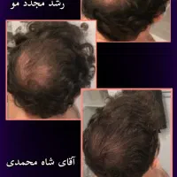 مشاوره تخصصی پوست و مو|آرایشی، بهداشتی، درمانی|تهران, دهم فروردین|دیوار