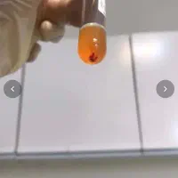 پی آرپیPRP درمان ریزش مو مزوتراپی هیرفیلر کاشت مو