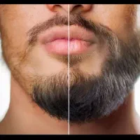 اصولی کم پشتی ریشتو درمان کن