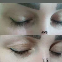 سفارش پکیج کامل صورت|آرایشی، بهداشتی، درمانی|شیراز, بازار|دیوار