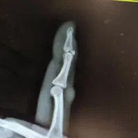 مراقبت از بیمار|استخدام درمانی، زیبایی، بهداشتی|رشت, معلم|دیوار