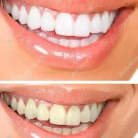 خدمات دندان پزشکی و دندانسازی