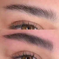 مدل برای فیبروز ابرو