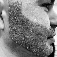 جشنوارهکاشت مو و ابرو و ریش وسبیل|خدمات آرایشگری و زیبایی|اهواز, اسماعیلیه|دیوار