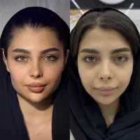 ژل وبوتاکس ،هایفو،پاک کردن تتو، دکتر جابری فر|خدمات آرایشگری و زیبایی|کرمانشاه, |دیوار