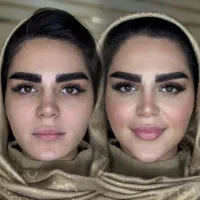 تخفیف خدمات مدلینگ فیلر بوتاکس مزوژل خانم و آقا|خدمات آرایشگری و زیبایی|تهران, پاسداران|دیوار