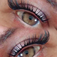 کاشت هیدن