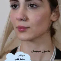 تزریق ژل وجوانسازی تخصصی ومزو ژل،بوتاکس|خدمات آرایشگری و زیبایی|شاهین‌شهر, فردوسی|دیوار