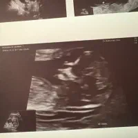 خانم  دستیار پزشک سونوگرافی