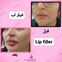 کلینیک لیزربوتاکس مزو دکترعلی حسین‌ زاده پرندبیمه|خدمات آرایشگری و زیبایی|پرند, |دیوار