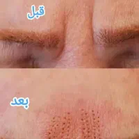 تخفیف روز مادر|آرایشی، بهداشتی، درمانی|مسجد سلیمان, |دیوار