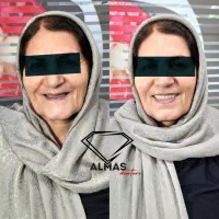 دست دندان