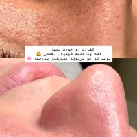 آفر پاکسازی صورت|خدمات آرایشگری و زیبایی|مشهد, ادیب نیشابوری (شهرک غرب)|دیوار