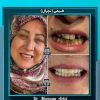 مرکز تخصصی ایمپلنت دندانپزشکی شیراز / تعرفه دولتی