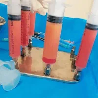 ساکشن شکم و پهلو با کمترین قیمت