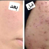 کرم وی آی پی تضمیمی|آرایشی، بهداشتی، درمانی|میبد, |دیوار