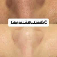 فیشال تخصصی پوست|خدمات آرایشگری و زیبایی|پرند, فاز ۵|دیوار